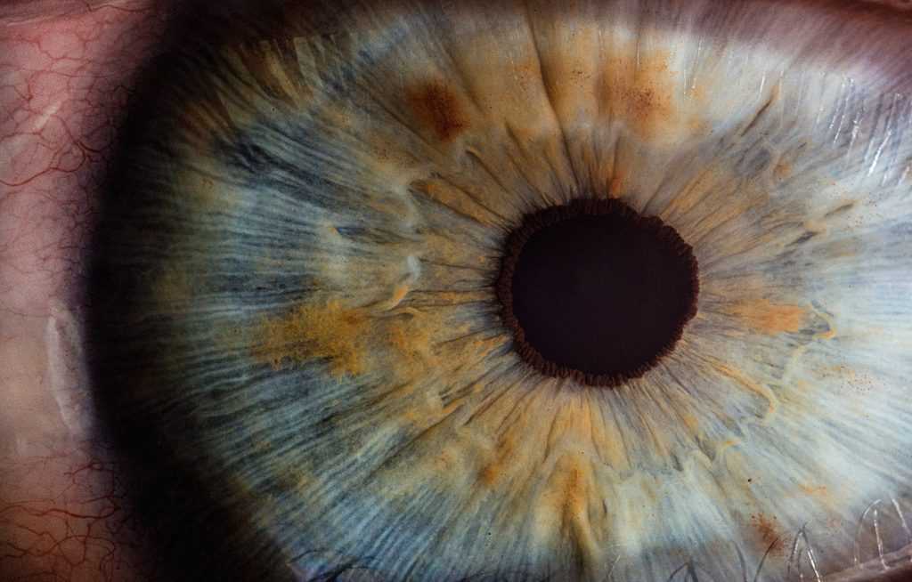 ogen iris